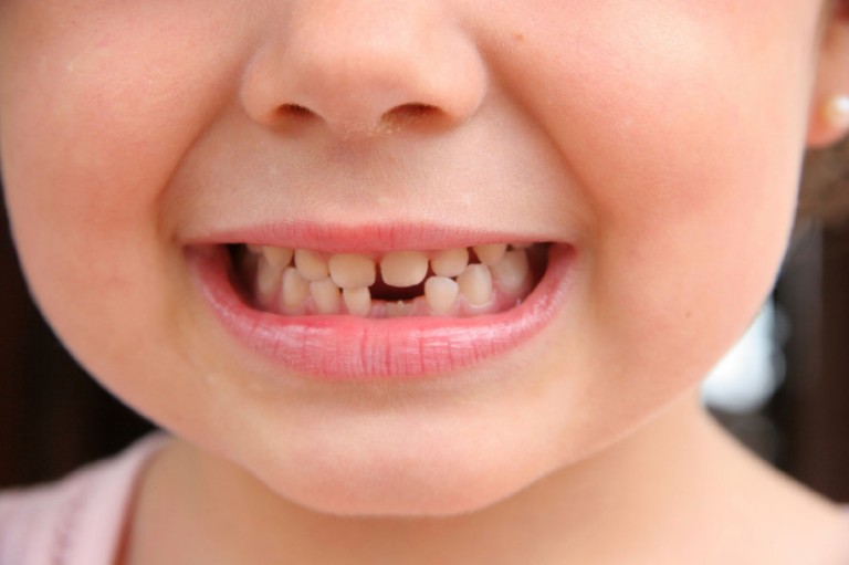 Mliječni zubi kod djece